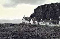 Опасные родинки: как их узнать?